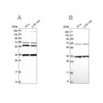 DNAJC17 Antibody in Western Blot (WB)