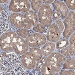 NAT15 Antibody in Immunohistochemistry (Paraffin) (IHC (P))