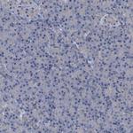 NAT15 Polyclonal Antibody
