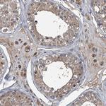NAT15 Antibody in Immunohistochemistry (Paraffin) (IHC (P))