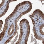 NAT15 Antibody in Immunohistochemistry (IHC)