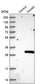 NAT15 Antibody in Western Blot (WB)