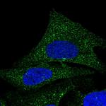COQ9 Polyclonal Antibody