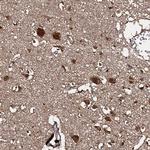 C18orf32 Antibody in Immunohistochemistry (Paraffin) (IHC (P))
