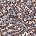 C18orf32 Antibody in Immunohistochemistry (Paraffin) (IHC (P))