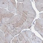 C18orf32 Antibody in Immunohistochemistry (Paraffin) (IHC (P))