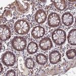 FAM98C Antibody in Immunohistochemistry (Paraffin) (IHC (P))