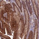 ANGPTL2 Antibody in Immunohistochemistry (Paraffin) (IHC (P))