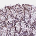 ZC3H4 Antibody in Immunohistochemistry (IHC)