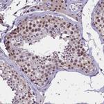 ZC3H4 Antibody in Immunohistochemistry (IHC)