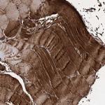 CPPED1 Antibody in Immunohistochemistry (Paraffin) (IHC (P))