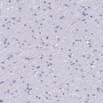 AHSP Antibody in Immunohistochemistry (IHC)