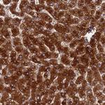 SPIRE1 Polyclonal Antibody