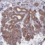 ZCCHC2 Antibody in Immunohistochemistry (Paraffin) (IHC (P))