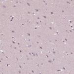 PSTPIP2 Antibody in Immunohistochemistry (Paraffin) (IHC (P))
