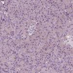 PSTPIP2 Antibody in Immunohistochemistry (Paraffin) (IHC (P))