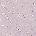 PSTPIP2 Antibody in Immunohistochemistry (IHC)