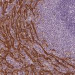 PSTPIP2 Antibody in Immunohistochemistry (IHC)