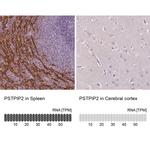 PSTPIP2 Antibody