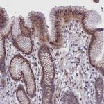 ALS Antibody in Immunohistochemistry (IHC)