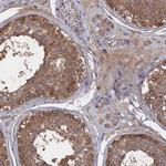 NUTF2 Antibody in Immunohistochemistry (IHC)