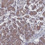 NUTF2 Antibody in Immunohistochemistry (IHC)