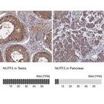 NUTF2 Antibody