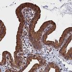 NUTF2 Antibody in Immunohistochemistry (IHC)
