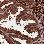 CCDC102A Polyclonal Antibody