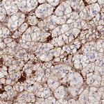TLX2 Antibody in Immunohistochemistry (Paraffin) (IHC (P))