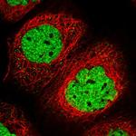 SAMD10 Polyclonal Antibody