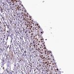 SAMD10 Antibody in Immunohistochemistry (Paraffin) (IHC (P))