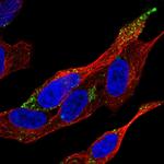 VPS37D Antibody in Immunocytochemistry (ICC/IF)