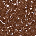 DTD1 Antibody in Immunohistochemistry (Paraffin) (IHC (P))