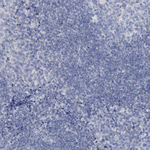 DTD1 Polyclonal Antibody