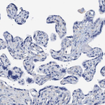DTD1 Antibody in Immunohistochemistry (Paraffin) (IHC (P))