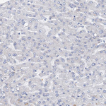 DTD1 Antibody in Immunohistochemistry (Paraffin) (IHC (P))