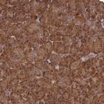 SNX33 Polyclonal Antibody