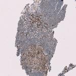 RMI2 Antibody in Immunohistochemistry (Paraffin) (IHC (P))