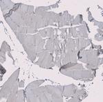 RMI2 Antibody in Immunohistochemistry (Paraffin) (IHC (P))