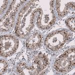 RMI2 Antibody in Immunohistochemistry (Paraffin) (IHC (P))