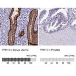PRR15 Polyclonal Antibody