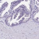 PRR15 Antibody in Immunohistochemistry (IHC)
