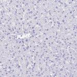 HOMER3 Antibody in Immunohistochemistry (Paraffin) (IHC (P))