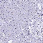 HOMER3 Antibody in Immunohistochemistry (Paraffin) (IHC (P))