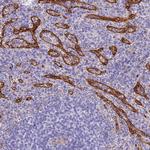 HOMER3 Antibody in Immunohistochemistry (Paraffin) (IHC (P))