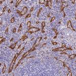 HOMER3 Antibody in Immunohistochemistry (IHC)