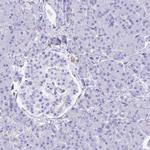 HOMER3 Antibody in Immunohistochemistry (IHC)
