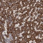 ROGDI Polyclonal Antibody
