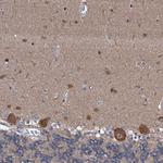 FLYWCH1 Antibody in Immunohistochemistry (Paraffin) (IHC (P))